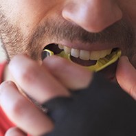 Patient putting in a mouthguard